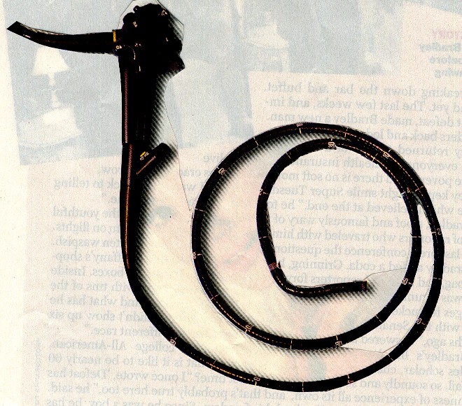 This is a "flexi-sig," the instrument inserted through the rectum and into the colon. If the doctor finds any polyps, he snips them out. The exam...